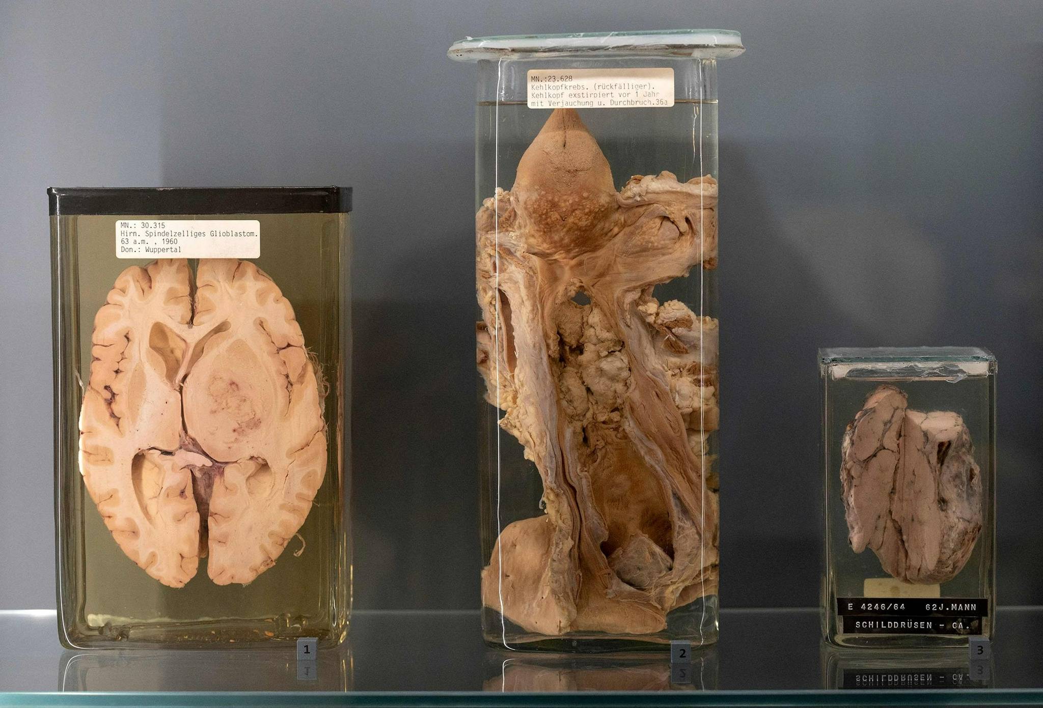 竞博APP下载注册：维也纳博物馆重新展出5万个人体器官包括肿大肝脏、畸形骨骼……(图1)