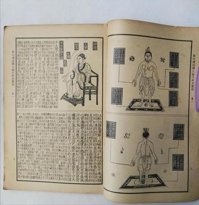竞博APP下载注册：日本惊现“针灸铜人”轰动了整个中医学界专家却称：这不可能！(图11)
